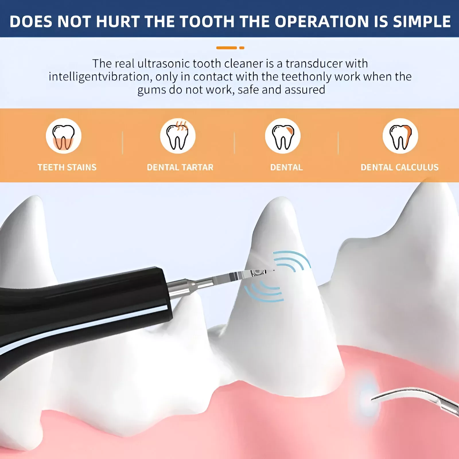 Pet Teeth Cleaning Tools - Image 7