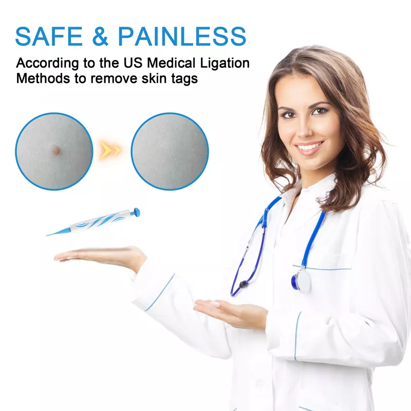 2-in-1 Auto Skin Tag Remover Kit with 40 Bands – Painless Skin Tag & Wart Removal Tool - Image 2